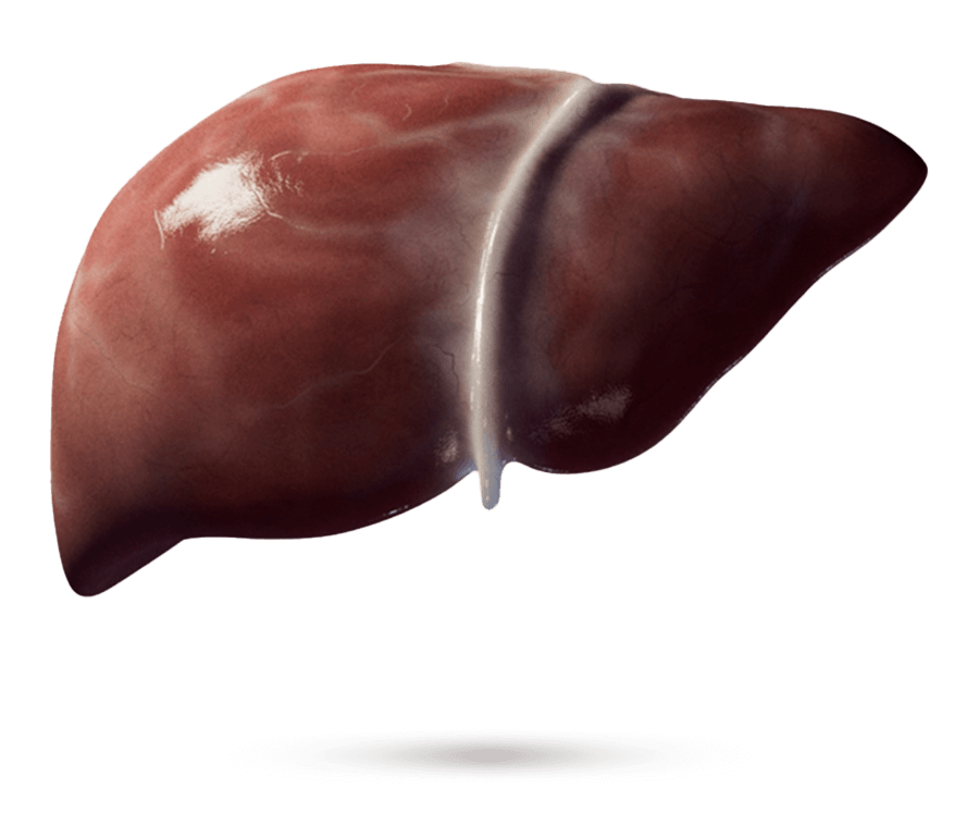 Medizinische Illustration einer Leber mit sichtbarer Fibrose.