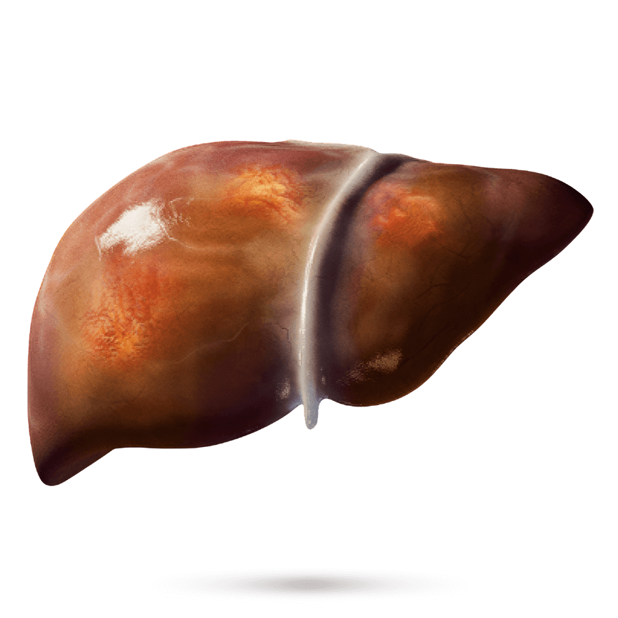 Liver 2