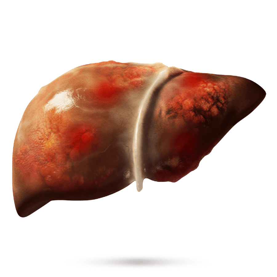 Liver 3