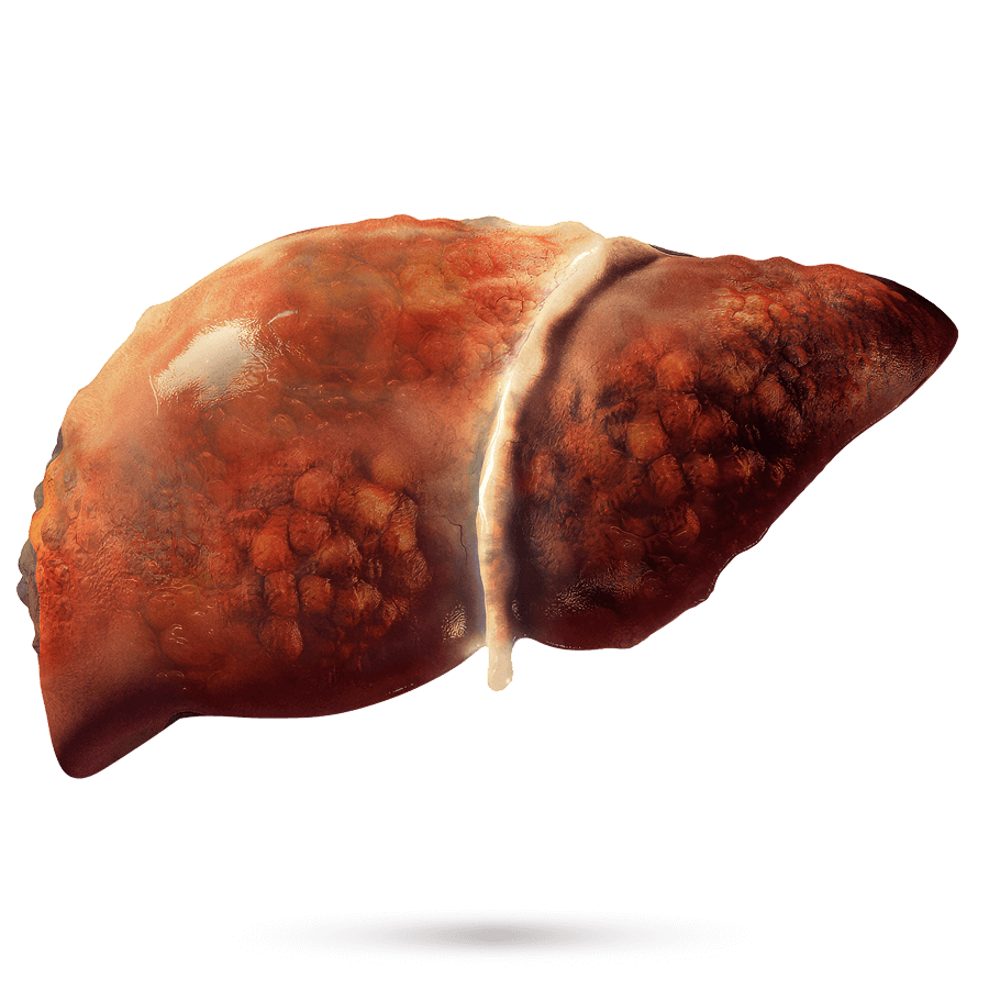 Liver 4