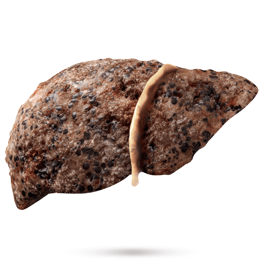 Liver 5